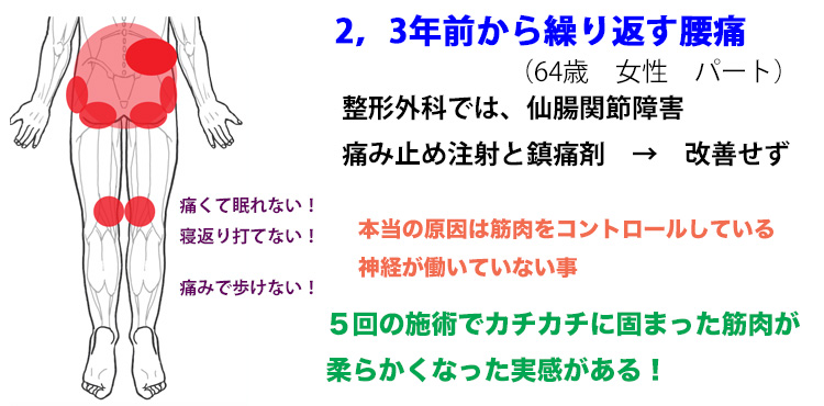 仙腸関節障害　腰痛　整体