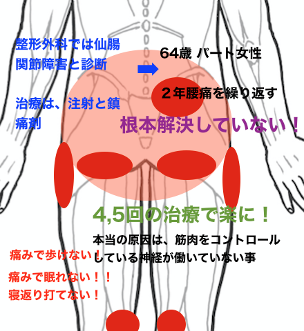 仙腸関節障害