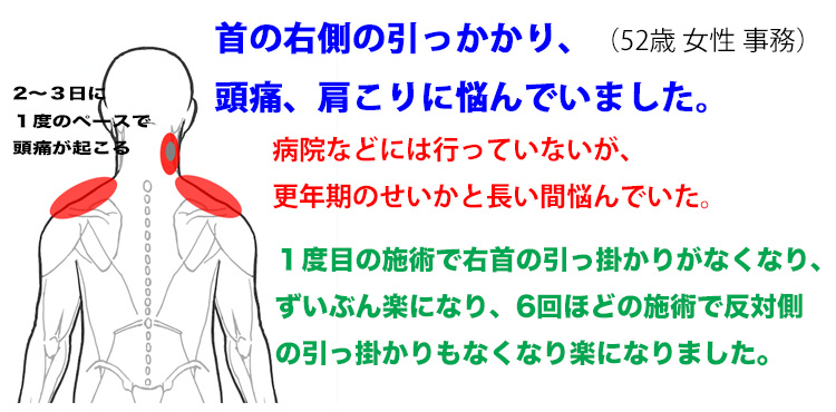 頭痛、肩こり　整体