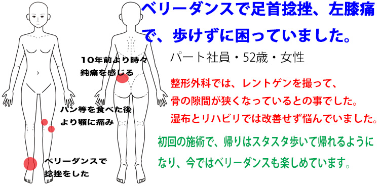 ベリーダンス　膝の痛み