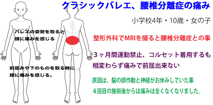 クラシックバレエ　福岡