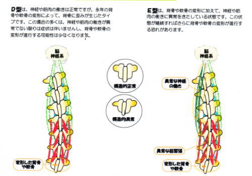 背骨のバランス