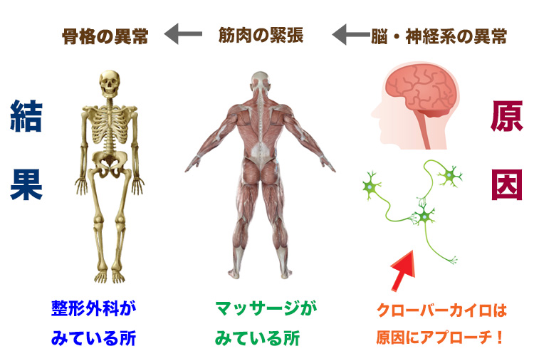 原因と結果