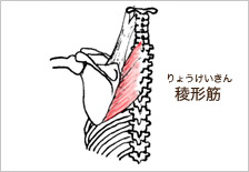 稜形筋