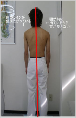 整体前