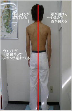 整体後