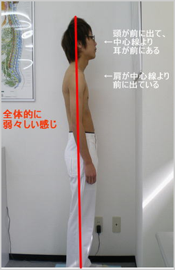 整体前