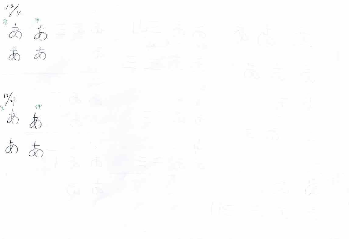 書痙　施術変化