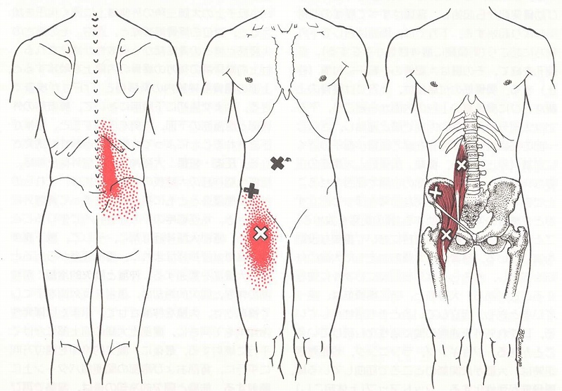 足腰の痛み